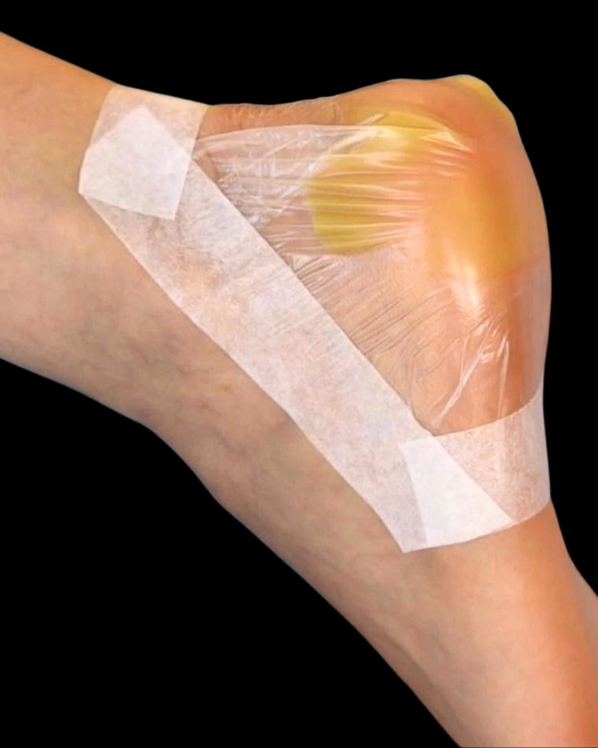 Helena Plöckl – Fußwerk - Fußpflege